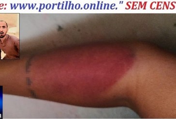 👉📢😠🔍🕵🔎🚑🚒⚖🚔Na Mira Mulher é estuprada e jurada de morte pelo ex: “Vai conhecer o diabo”