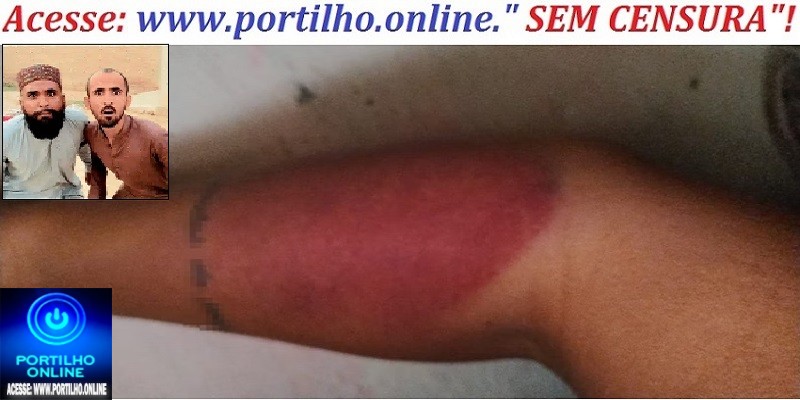 👉📢😠🔍🕵🔎🚑🚒⚖🚔Na Mira Mulher é estuprada e jurada de morte pelo ex: “Vai conhecer o diabo”