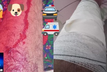 📢🚔🚑🗣💉🐶Aí,  fui mordido por 🐕‍🦺 cão 🐕‍🦺! Boa tarde Portilho! Venho encarecidamente lhe pedi para que poste em seu site