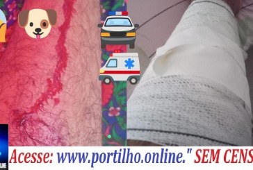 📢🚔🚑🗣💉🐶Aí,  fui mordido por 🐕‍🦺 cão 🐕‍🦺! Boa tarde Portilho! Venho encarecidamente lhe pedi para que poste em seu site
