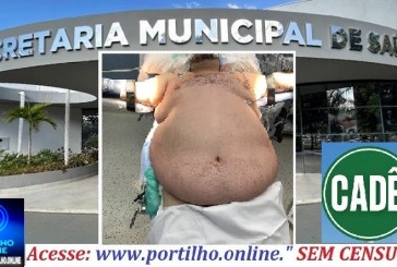 👉😱💣⁉Cadê as cirurgias bariátricas? 🚨🩺🩻🩸💊🧬💉🚑🩼😥Portilho e gostaria de conversar…