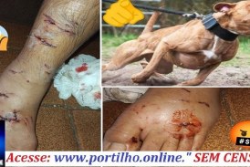 👉📢🚑🚨🔍🕵🔎🚔⚖👿🐕🐈Ataque de Pit Bull: Portilho Esse foi o jovem mordido brutalmente pelo pit bul no dia 16 /6 /25