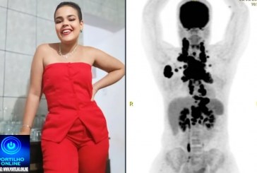 📢🧐🚑🚒✍🚨🩼🩻🩺💊Jovem conta sinais que ignorou de câncer que a “esmagava por dentro”