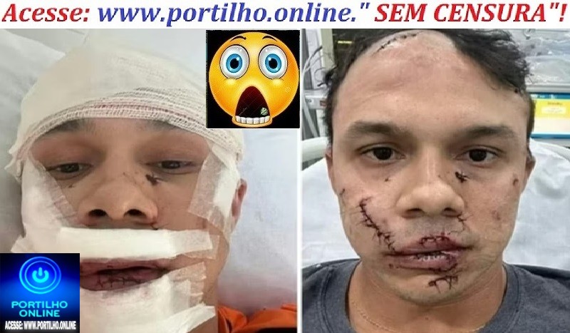 👉🚔👀🔎😱🔎🚨🚔🚒🚑🚓Na Mira Saiba o que disse na DP playboy que espancou personal em briga de bar