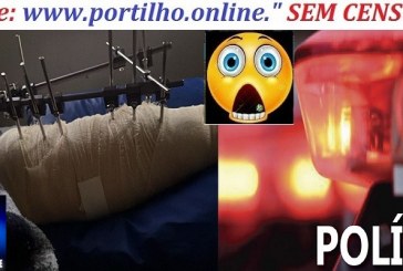 👉📢🤬😡🚓🚔🚒🚑Bom dia Portilho, fui atropelada, a minha perna toda cheia de ferro.