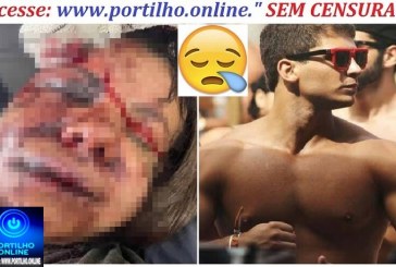 👉📢😱😳🤬🚔🚨🚓🚑🚒 Na Mira  – Mulher espancada com 60 socos pelo ex: “Ele disse que iria me matar”