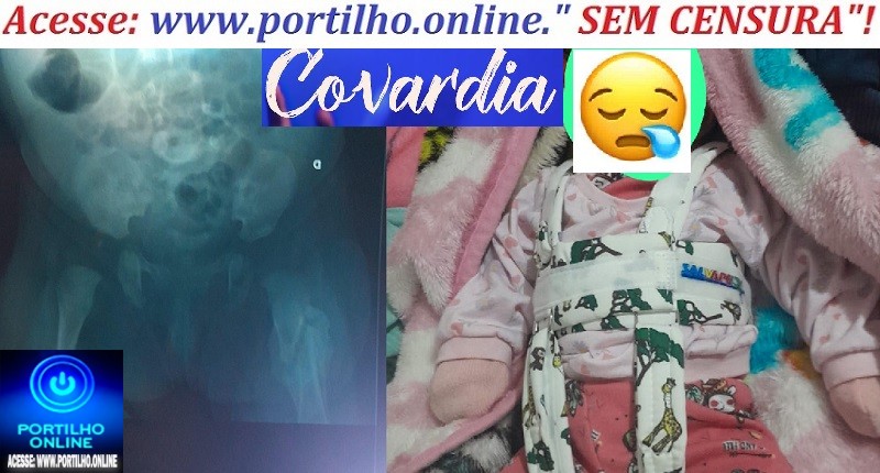 📢 Denúnciasssss 👉😱💣⁉ 🚨🩺🩻🩸💊🧬💉🚑🩼😥Portilho e gostaria de conversar…Essa bebezinha sofreu fratura após cesariana. Ouçam os áudios…
