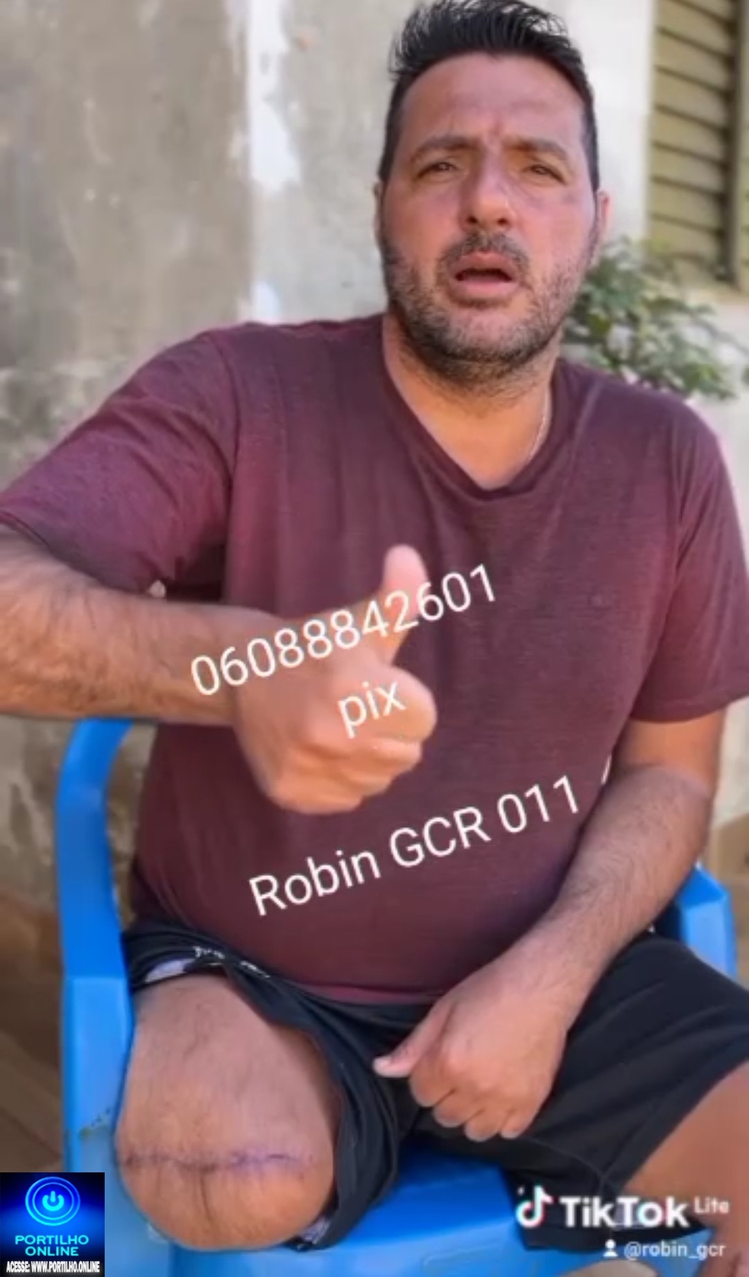 👉🤝✍😪🙏🤝🙌💚✨ *VAQUINHA SOLIDÁRIA – AJUDE O ROBSON!* ✨💚