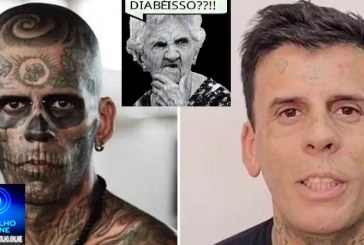 👉🤔😱🧐👎👀👁Homem ‘mais tatuado do Brasil’ vira evangélico e surge irreconhecível após sessões de remoção a laser; veja