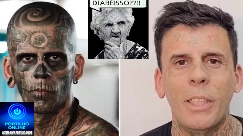 👉🤔😱🧐👎👀👁Homem ‘mais tatuado do Brasil’ vira evangélico e surge irreconhecível após sessões de remoção a laser; veja