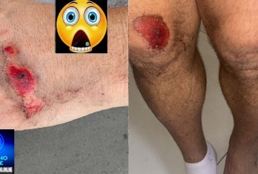 👉🚨🚧🛑🚏🚑🚒🍻🥂🍺🍋🚨 Acidente Então… Sei que seu canal é bem conhecido aqui na região,segunda-feira, era umas seis e meia da manhã, lá no Enéias