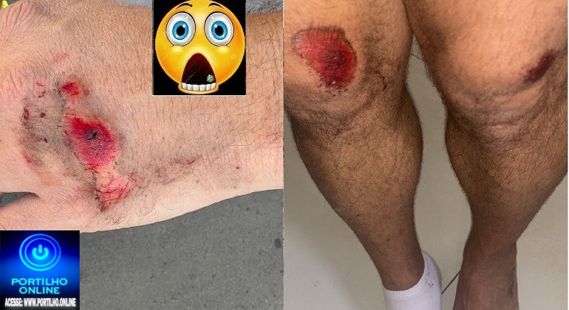 👉🚨🚧🛑🚏🚑🚒🍻🥂🍺🍋🚨 Acidente Então… Sei que seu canal é bem conhecido aqui na região,segunda-feira, era umas seis e meia da manhã, lá no Enéias