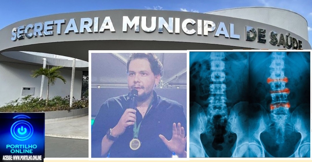 📢?🫵👉 Secretaria de Saúde 😱💣⁉ 🚨🩺🩻🩸💊🧬   O prefeito Dr Gustavo Brasileiro vai ficar sabendo de mais essa..Fui diagnosticada com  Espondilite Anquilosante 