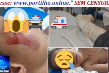 📢🚧😡 vídeos….🫵🚒🚑🚨🚔😱 Acidente! “Tocador” de motocicleta 🏍️ atropela criança 🚸 — e adivinha? É “de menor”! 😡