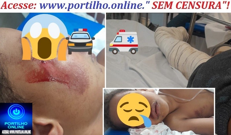 📢🚧😡 vídeos….🫵🚒🚑🚨🚔😱 Acidente! “Tocador” de motocicleta 🏍️ atropela criança 🚸 — e adivinha? É “de menor”! 😡