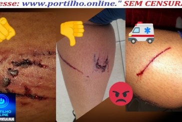 👉🫵😡🐕‍🦺🛒📢👊🚔🚑🚒🦮🐈‍⬛Cães de rua abandonados em frente ao mercado Roda Viva “ataca aposentado” um idoso de 90 anos