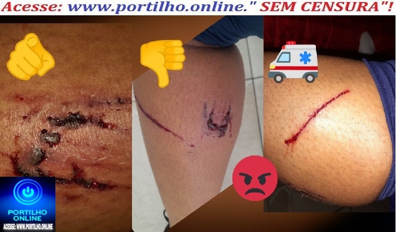 👉🫵😡🐕‍🦺🛒📢👊🚔🚑🚒🦮🐈‍⬛Cães de rua abandonados em frente ao mercado Roda Viva “ataca aposentado” um idoso de 90 anos