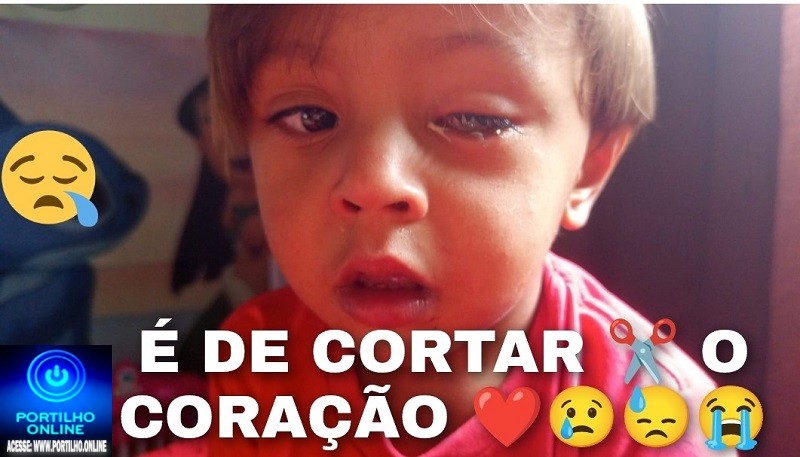 👉😓😢😇😡🩺🩻🩹 É de cortar  o coração  criançinha sofrendo dores de chegar a morder na toalha