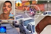 👉🚑😱 Vídeo 🚓🚧🚨🫵👣😡👎👏Tocador de moto passa em cima do pé  de jovem de propósito