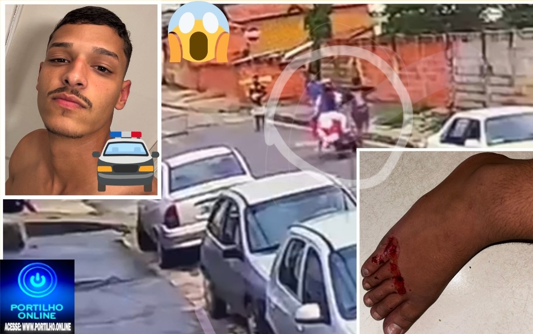 👉🚑😱 Vídeo 🚓🚧🚨🫵👣😡👎👏Tocador de moto passa em cima do pé  de jovem de propósito