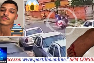 👉🚑😱 Vídeo 🚓🚧🚨🫵👣😡👎👏Tocador de moto passa em cima do pé  de jovem de propósito