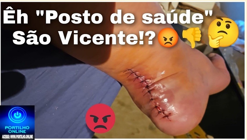 👉🫵 Reclamações…😡🚑🩻🩺🩹💊💉Êh posto de saúde São Vicente!?Portilho Boa tarde meu amigo! Sou deficiente físico. Estou em tratamento oncológico.