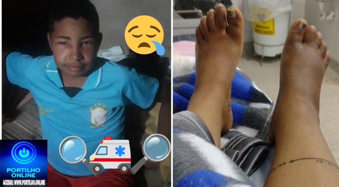 👉🤔🙂‍↕🫵😪😥🫂💔 Solidariedade: Adolescente de 12 anos enfrenta doença rara e família pede 🆘💉💊🩹🩺🩺