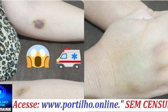 👉🏻📢🚨🫵🏻🚑👀🩻🩺🩹💊💉💉💉Pronto Socorrooooo💊💉💉💉!!!!”🫵🏻Portilho ela foi me picando umas dez vez”