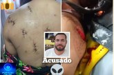 👉🏻🗡🔪🚔🚒🚑😱🚨Essa mulher foi golpeada com 🔪🗡facadas nas costas e sofreu tentativa de degola em um caso de tentativa de feminicídio.🗡 🔪.