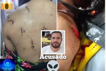 👉🏻🗡🔪🚔🚒🚑😱🚨Essa mulher foi golpeada com 🔪🗡facadas nas costas e sofreu tentativa de degola em um caso de tentativa de feminicídio.🗡 🔪.