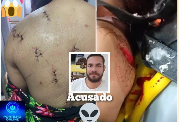 👉🏻🗡🔪🚔🚒🚑😱🚨Essa mulher foi golpeada com 🔪🗡facadas nas costas e sofreu tentativa de degola em um caso de tentativa de feminicídio.🗡 🔪.
