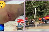 👉🏻😱🚒🚑🚨🫵🏻🚓🦴😡😠Acidente com fratura exposta: motociclista arremessado contra poste aguarda cirurgia