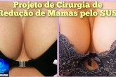 👉🏻🫵🏻🤔😱🧬🩺🩻💊💉Mulheres dos seios Seios excessivamente. Ola Portilho peço a sua ajuda pra tá divulgando.