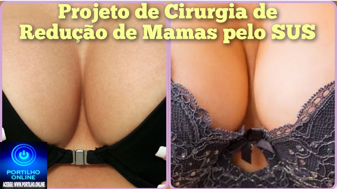 👉🏻🫵🏻🤔😱🧬🩺🩻💊💉Mulheres dos seios Seios excessivamente. Ola Portilho peço a sua ajuda pra tá divulgando.