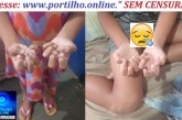 👉🩻📢🩺🩹💊🥼🚑Ouçam os áudios do pedido de socorro… Gente, olha só que situação humilhante por falta de tratamento adequado