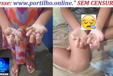 👉🩻📢🩺🩹💊🥼🚑Ouçam os áudios do pedido de socorro… Gente, olha só que situação humilhante por falta de tratamento adequado