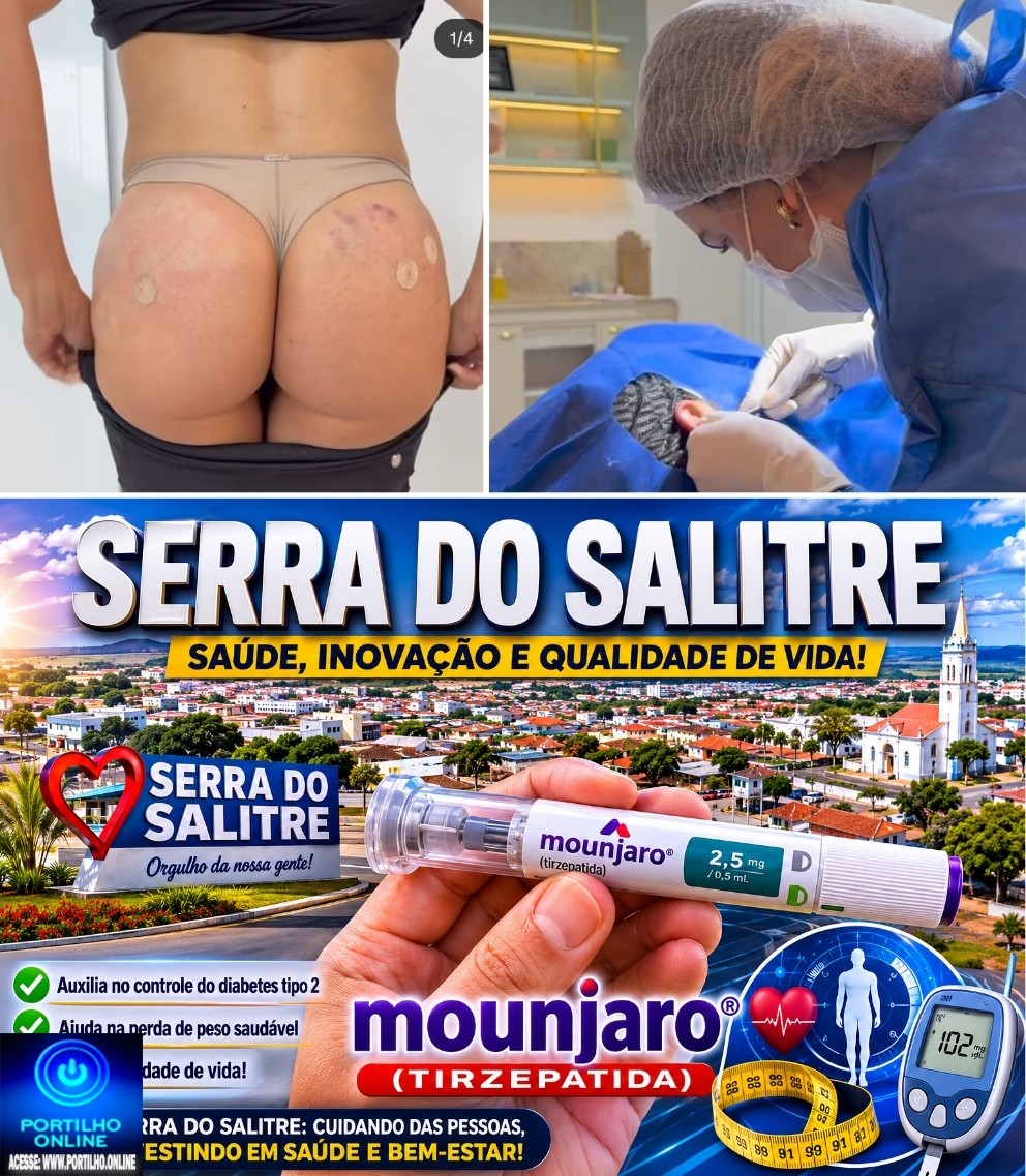 💉💊🩺🫵🏻🩻🩺Serra do Salitre “Mounjaro “. Portilho, esses procedimentos teria ser feito em hospital