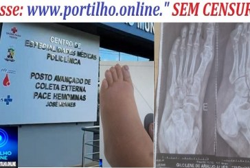 👉😡 PÉ INCHADO E BRADO😠👎🚨🚑🩺🩻🩹💊🦶😖 PACIENTE COM O PÉ QUEBRADO E INCHADO, ENFIM, SERÁ ATENDIDA NA POLICLÍNICA!