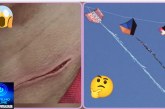 👉🏻🫵🏻😳🚨🚑🚔🚒😱🫨Cuidado com o seu pescoço. As linhas de cerol (chilena) Oi Portilho gostaria que vc nós ajudasse