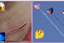 👉🏻🫵🏻😳🚨🚑🚔🚒😱🫨Cuidado com o seu pescoço. As linhas de cerol (chilena) Oi Portilho gostaria que vc nós ajudasse