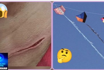 👉🏻🫵🏻😳🚨🚑🚔🚒😱🫨Cuidado com o seu pescoço. As linhas de cerol (chilena) Oi Portilho gostaria que vc nós ajudasse