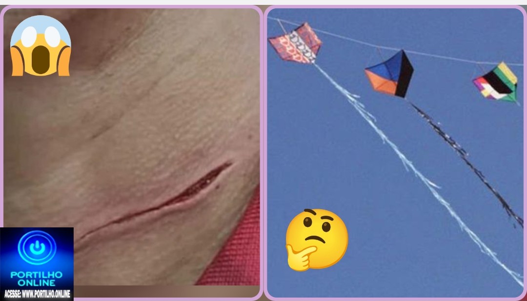 👉🏻🫵🏻😳🚨🚑🚔🚒😱🫨Cuidado com o seu pescoço. As linhas de cerol (chilena) Oi Portilho gostaria que vc nós ajudasse