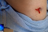 👉🏻🤔🐶 Alerta de perigo 😱😯😨🚨🗣️🚑🚒🦮🐕Meu filho foi mordido na Praça Honorato Borges