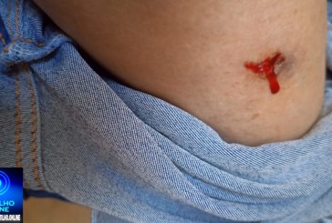 👉🏻🤔🐶 Alerta de perigo 😱😯😨🚨🗣️🚑🚒🦮🐕Meu filho foi mordido na Praça Honorato Borges