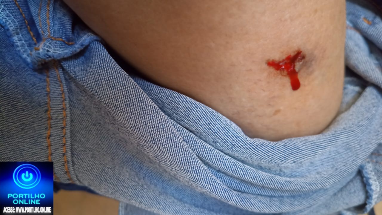 👉🏻🤔🐶 Alerta de perigo 😱😯😨🚨🗣️🚑🚒🦮🐕Meu filho foi mordido na Praça Honorato Borges