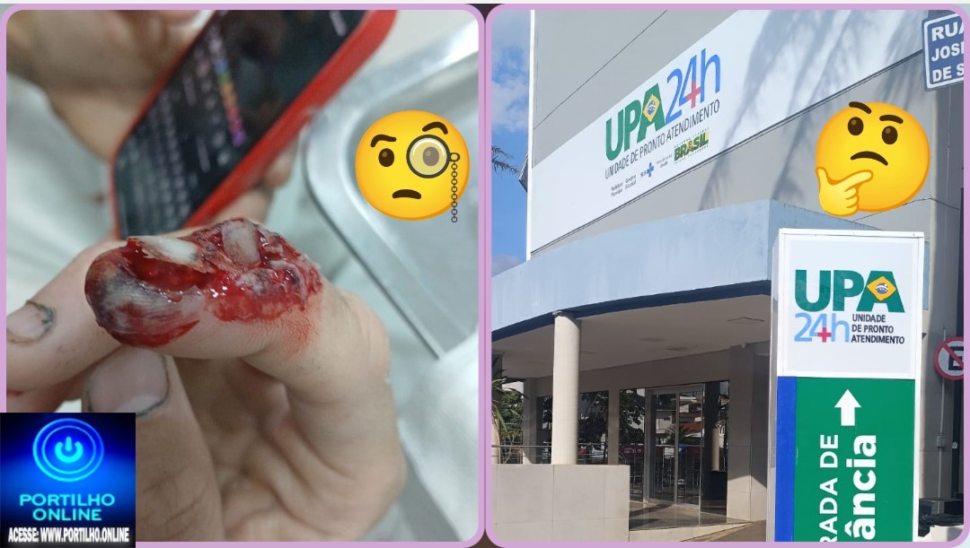 👉🏻🏥🚨😢 UPA 24 HORAS! MAS QUEM REALMENTE MANDA? “AÍ, MEU DEDO QUEBRADO!” 😢😞