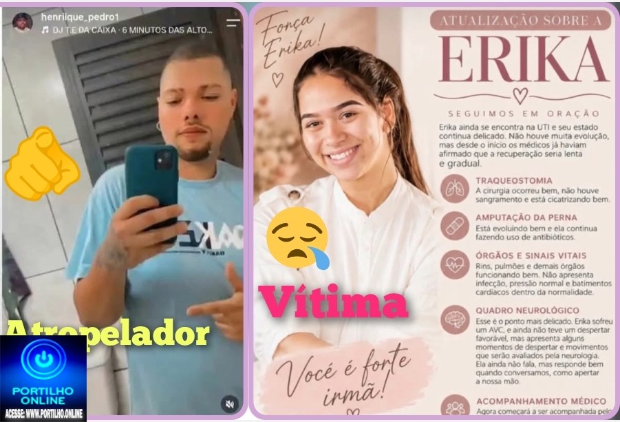 👉🏻🫵🏻🚑🚒🚨😱Foi ele que atropelou e fugiu? Covardão😡😤. Portilho sobre o acidente que aconteceu onde essa jovem Erika perdeu a perna