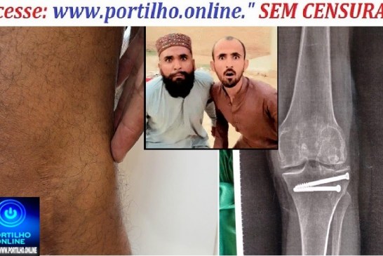 👉🗣🧐🚑🤔🦵 QUEM É O “MÉDICO ORTOPEDISTA”?! PACIENTE RECLAMA DE “PING-PONG” NO ATENDIMENTO DA SAÚDE