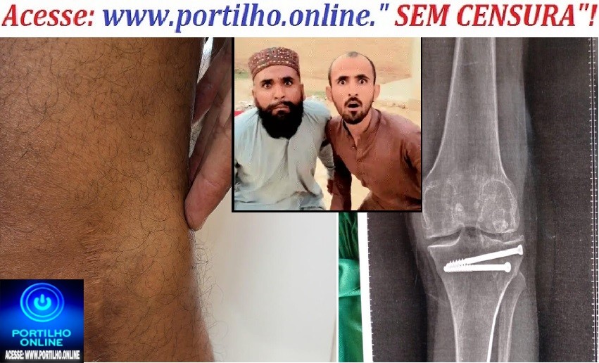 👉🗣🧐🚑🤔🦵 QUEM É O “MÉDICO ORTOPEDISTA”?! PACIENTE RECLAMA DE “PING-PONG” NO ATENDIMENTO DA SAÚDE