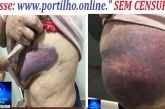 👉😱🚔🚒😪🚑Agressões em Coromadel 🚨🚔 LEI MARIA DA PENHA – AGRESSÃO VIOLENTA CONTRA MULHER DE 57 ANOS!